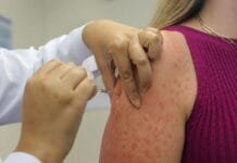Sarampo volta a acender alerta no Brasil; Rio das Ostras reforça vacinação preventiva Foto de pessoa sendo vacinada